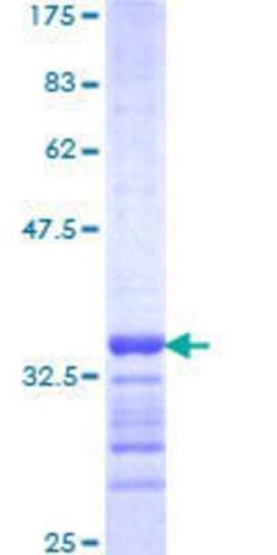 Novus Biologicals Recombinant Human FBXO8 GST (N-Term) Protein 25 &mu;g | Buy Online | Novus Biologicals&trade; | Fisher Scientific