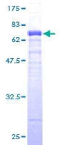 Novus Biologicals Recombinant Human FBXO4 GST (N-Term) Protein 10 &mu;g | Buy Online | Novus Biologicals&trade; | Fisher Scientific