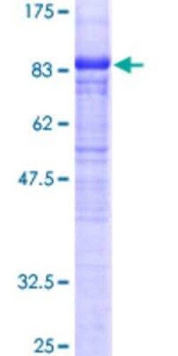 Novus Biologicals Recombinant Human FBXO3 GST (N-Term) Protein 25 &mu;g | Buy Online | Novus Biologicals&trade; | Fisher Scientific
