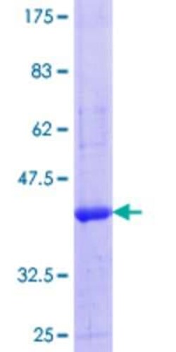 Novus Biologicals Recombinant Human FBXO3 GST (N-Term) Protein 25 &mu;g | Buy Online | Novus Biologicals&trade; | Fisher Scientific