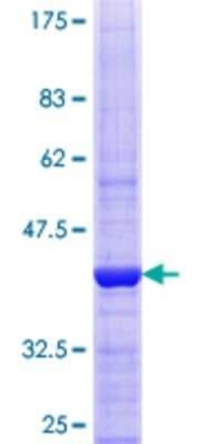Novus Biologicals Recombinant Human VPS33B GST (N-Term) Protein 10 &mu;g | Buy Online | Novus Biologicals&trade; | Fisher Scientific
