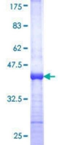 Novus Biologicals Recombinant Human TIN2 GST (N-Term) Protein 25 &mu;g | Buy Online | Novus Biologicals&trade; | Fisher Scientific