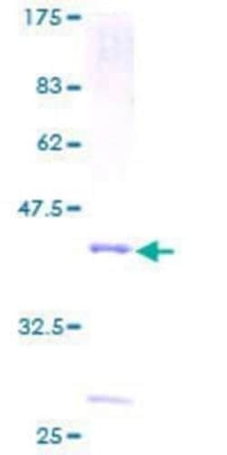 Novus Biologicals Recombinant Human Phospholipase A2 IID GST (N-Term) Protein 2 &mu;g | Buy Online | Novus Biologicals&trade; | Fisher Scientific