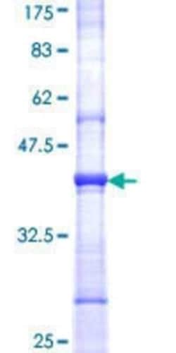 Novus Biologicals Recombinant Human GBGT1 GST (N-Term) Protein 2 &mu;g | Buy Online | Novus Biologicals&trade; | Fisher Scientific