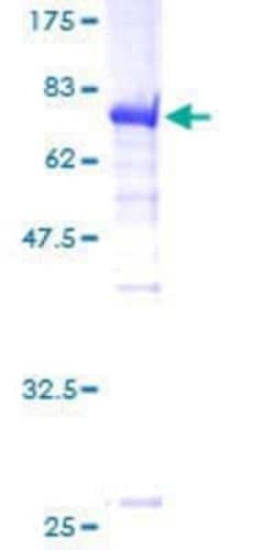 Novus Biologicals Recombinant Human GAPDH-2 GST (N-Term) Protein 10 &mu;g | Buy Online | Novus Biologicals&trade; | Fisher Scientific