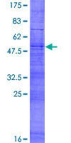 Novus Biologicals Recombinant Human OR7A17 GST (N-Term) Protein 2 &mu;g | Buy Online | Novus Biologicals&trade; | Fisher Scientific