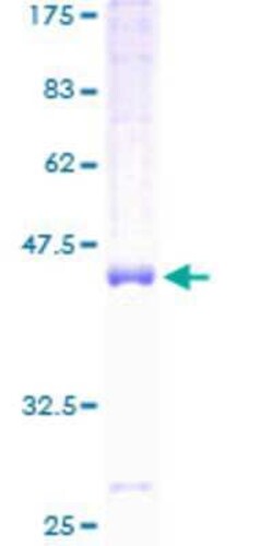 Novus Biologicals Recombinant Human FAM162A GST (N-Term) Protein 10 &mu;g | Buy Online | Novus Biologicals&trade; | Fisher Scientific