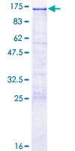 Novus Biologicals Recombinant Human SEZ6L2/BSRP-A GST (N-Term) Protein 10 &mu;g | Buy Online | Novus Biologicals&trade; | Fisher Scientific
