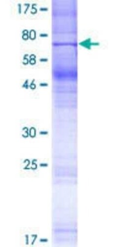 Novus Biologicals Recombinant Human OR8G1 GST (N-Term) Protein 2 &mu;g | Buy Online | Novus Biologicals&trade; | Fisher Scientific