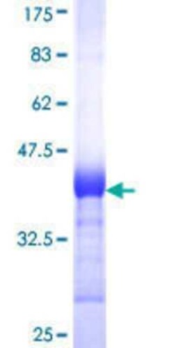 Novus Biologicals Recombinant Human NARF GST (N-Term) Protein 25 &mu;g | Buy Online | Novus Biologicals&trade; | Fisher Scientific