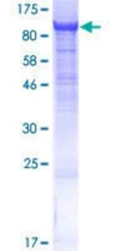 Novus Biologicals Recombinant Human CNNM4 GST (N-Term) Protein 25 &mu;g | Buy Online | Novus Biologicals&trade; | Fisher Scientific