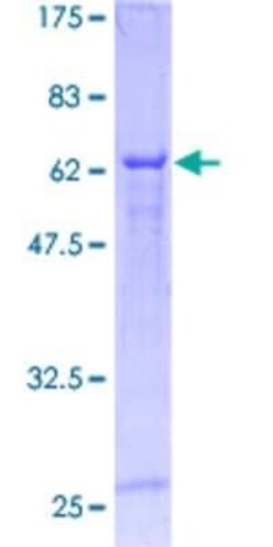 Novus Biologicals Recombinant Human Cyclin M3 GST (N-Term) Protein 10 &mu;g | Buy Online | Novus Biologicals&trade; | Fisher Scientific