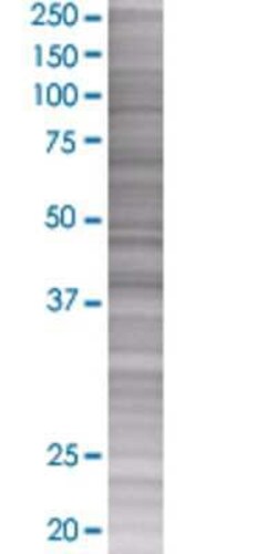 Novus Biologicals Cyclin M3 293T Cell Transient Overexpression Lysate 0.1 mL | Buy Online | Novus Biologicals&trade; | Fisher Scientific
