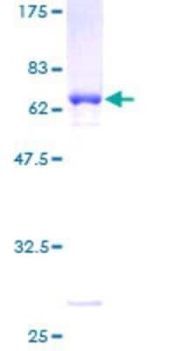 Novus Biologicals Recombinant Human Hey L GST (N-Term) Protein 2 &mu;g | Buy Online | Novus Biologicals&trade; | Fisher Scientific