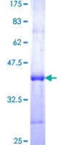 Novus Biologicals&trade;&nbsp;Recombinant Human Myoferlin GST (N-Term) Protein
