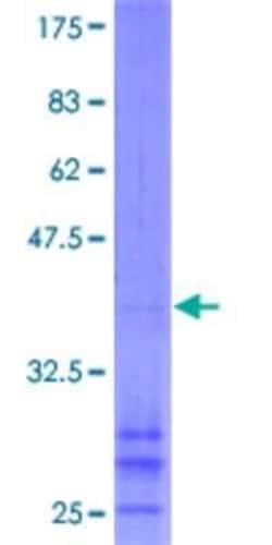 Novus Biologicals Recombinant Human CHIC2 GST (N-Term) Protein 10 &mu;g | Buy Online | Novus Biologicals&trade; | Fisher Scientific