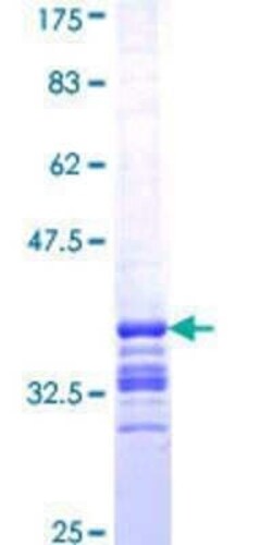 Novus Biologicals Recombinant Human CHIC2 GST (N-Term) Protein 25 &mu;g | Buy Online | Novus Biologicals&trade; | Fisher Scientific