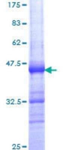 Novus Biologicals Recombinant Human INTS6 GST (N-Term) Protein 25 &mu;g | Buy Online | Novus Biologicals&trade; | Fisher Scientific