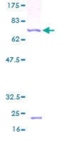 Novus Biologicals Recombinant Human TIMM13 GST (N-Term) Protein 10 &mu;g | Buy Online | Novus Biologicals&trade; | Fisher Scientific
