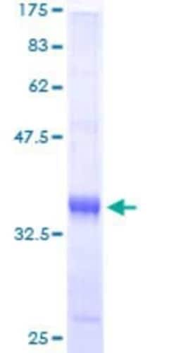 Novus Biologicals Recombinant Human TIMM9 GST (N-Term) Protein 25 &mu;g | Buy Online | Novus Biologicals&trade; | Fisher Scientific