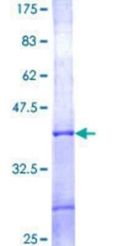 Novus Biologicals Recombinant Human TIMM9 GST (N-Term) Protein 10 &mu;g | Buy Online | Novus Biologicals&trade; | Fisher Scientific