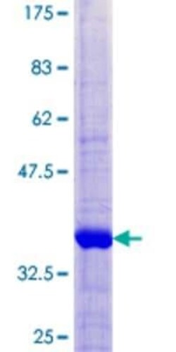 Novus Biologicals Recombinant Human TIMM8B GST (N-Term) Protein 25 &mu;g | Buy Online | Novus Biologicals&trade; | Fisher Scientific