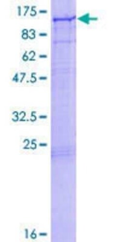 Novus Biologicals Recombinant Human AGO1/EIF2C1 GST (N-Term) Protein 2 &mu;g | Buy Online | Novus Biologicals&trade; | Fisher Scientific