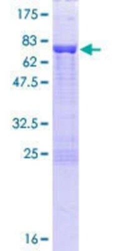 Novus Biologicals Recombinant Human DAZAP1 GST (N-Term) Protein 25 &mu;g | Buy Online | Novus Biologicals&trade; | Fisher Scientific