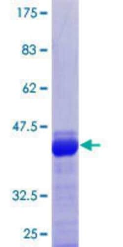 Novus Biologicals Recombinant Human DAZAP1 GST (N-Term) Protein 25 &mu;g | Buy Online | Novus Biologicals&trade; | Fisher Scientific