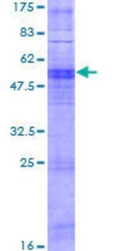 Novus Biologicals Recombinant Human OR11A1 GST (N-Term) Protein 2 &mu;g | Buy Online | Novus Biologicals&trade; | Fisher Scientific