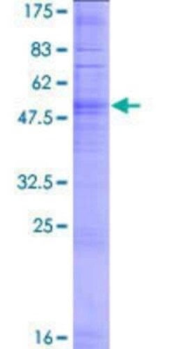 Novus Biologicals Recombinant Human OR10G3 GST (N-Term) Protein 2 &mu;g | Buy Online | Novus Biologicals&trade; | Fisher Scientific