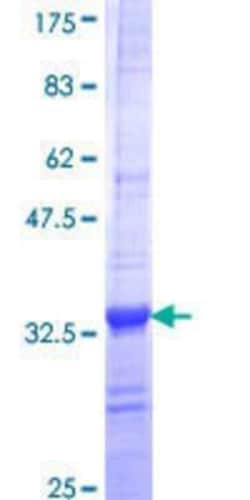 Novus Biologicals Recombinant Human Melusin/ITGB1BP2 GST (N-Term) Protein 25 &mu;g | Buy Online | Novus Biologicals&trade; | Fisher Scientific