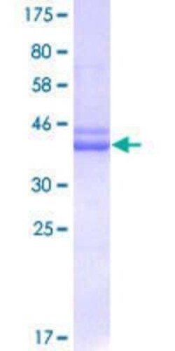 Novus Biologicals Recombinant Human AATF GST (N-Term) Protein 25 &mu;g | Buy Online | Novus Biologicals&trade; | Fisher Scientific