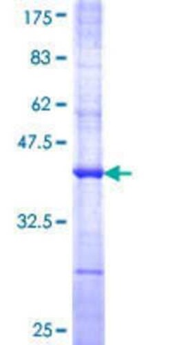 Novus Biologicals Recombinant Human PCOLCE2 GST (N-Term) Protein 10 &mu;g | Buy Online | Novus Biologicals&trade; | Fisher Scientific