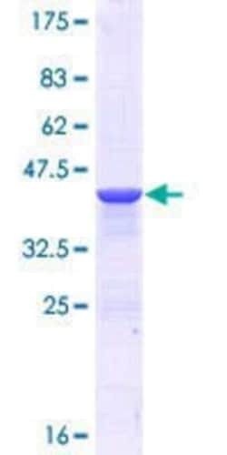 Novus Biologicals Recombinant Human Seipin/BSCL2 GST (N-Term) Protein 25 &mu;g | Buy Online | Novus Biologicals&trade; | Fisher Scientific