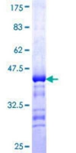 Novus Biologicals Recombinant Human Seipin/BSCL2 GST (N-Term) Protein 25 &mu;g | Buy Online | Novus Biologicals&trade; | Fisher Scientific