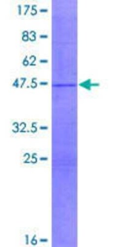 Novus Biologicals Recombinant Human DUX3 GST (N-Term) Protein 2 &mu;g | Buy Online | Novus Biologicals&trade; | Fisher Scientific