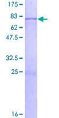 Novus Biologicals Recombinant Human TBL2 GST (N-Term) Protein 25 &mu;g | Buy Online | Novus Biologicals&trade; | Fisher Scientific
