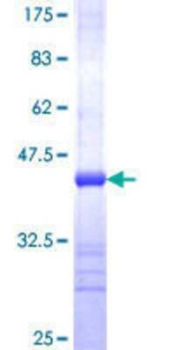Novus Biologicals Recombinant Human TBL2 GST (N-Term) Protein 25 &mu;g | Buy Online | Novus Biologicals&trade; | Fisher Scientific