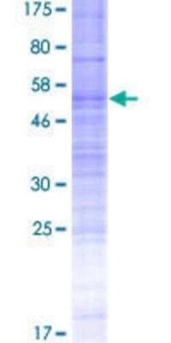 Novus Biologicals Recombinant Human OR7C2 GST (N-Term) Protein 2 &mu;g | Buy Online | Novus Biologicals&trade; | Fisher Scientific
