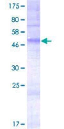 Novus Biologicals Recombinant Human OR4E2 GST (N-Term) Protein 2 &mu;g | Buy Online | Novus Biologicals&trade; | Fisher Scientific