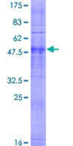 Novus Biologicals Recombinant Human OR4D1 GST (N-Term) Protein 2 &mu;g | Buy Online | Novus Biologicals&trade; | Fisher Scientific