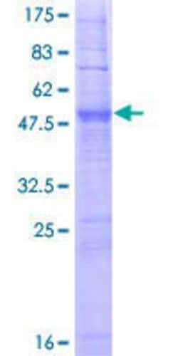 Novus Biologicals Recombinant Human OR2J2 GST (N-Term) Protein 2 &mu;g | Buy Online | Novus Biologicals&trade; | Fisher Scientific