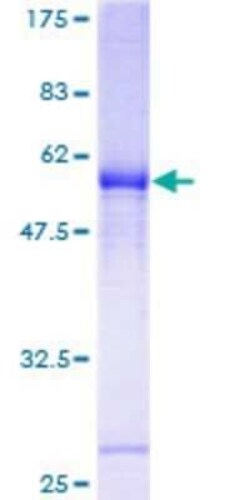 Novus Biologicals Recombinant Human OR2H1 GST (N-Term) Protein 2 &mu;g | Buy Online | Novus Biologicals&trade; | Fisher Scientific