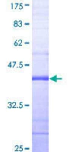 Novus Biologicals Recombinant Human RPS6KC1 GST (N-Term) Protein 25 &mu;g | Buy Online | Novus Biologicals&trade; | Fisher Scientific