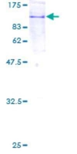 Novus Biologicals Recombinant Human COPG2 GST (N-Term) Protein 2 &mu;g | Buy Online | Novus Biologicals&trade; | Fisher Scientific