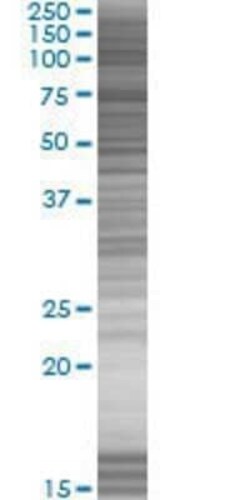 Novus Biologicals HBP1 293T Cell Transient Overexpression Lysate 0.1 mL | Buy Online | Novus Biologicals&trade; | Fisher Scientific