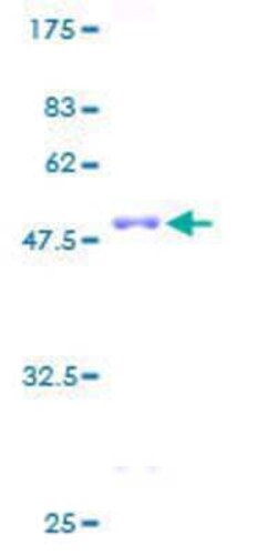 Novus Biologicals Recombinant Human RNF11 GST (N-Term) Protein 25 &mu;g | Buy Online | Novus Biologicals&trade; | Fisher Scientific