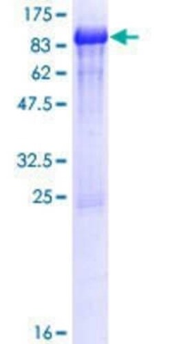 Novus Biologicals Recombinant Human Fetuin GST (N-Term) Protein 25 &mu;g | Buy Online | Novus Biologicals&trade; | Fisher Scientific