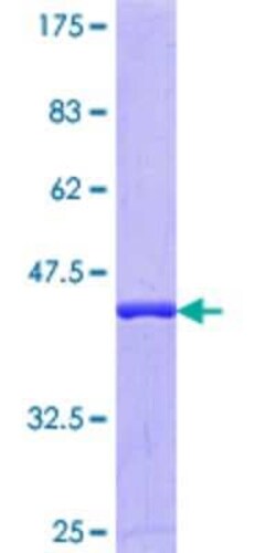 Novus Biologicals Recombinant Human DNAJC2 GST (N-Term) Protein 25 &mu;g | Buy Online | Novus Biologicals&trade; | Fisher Scientific